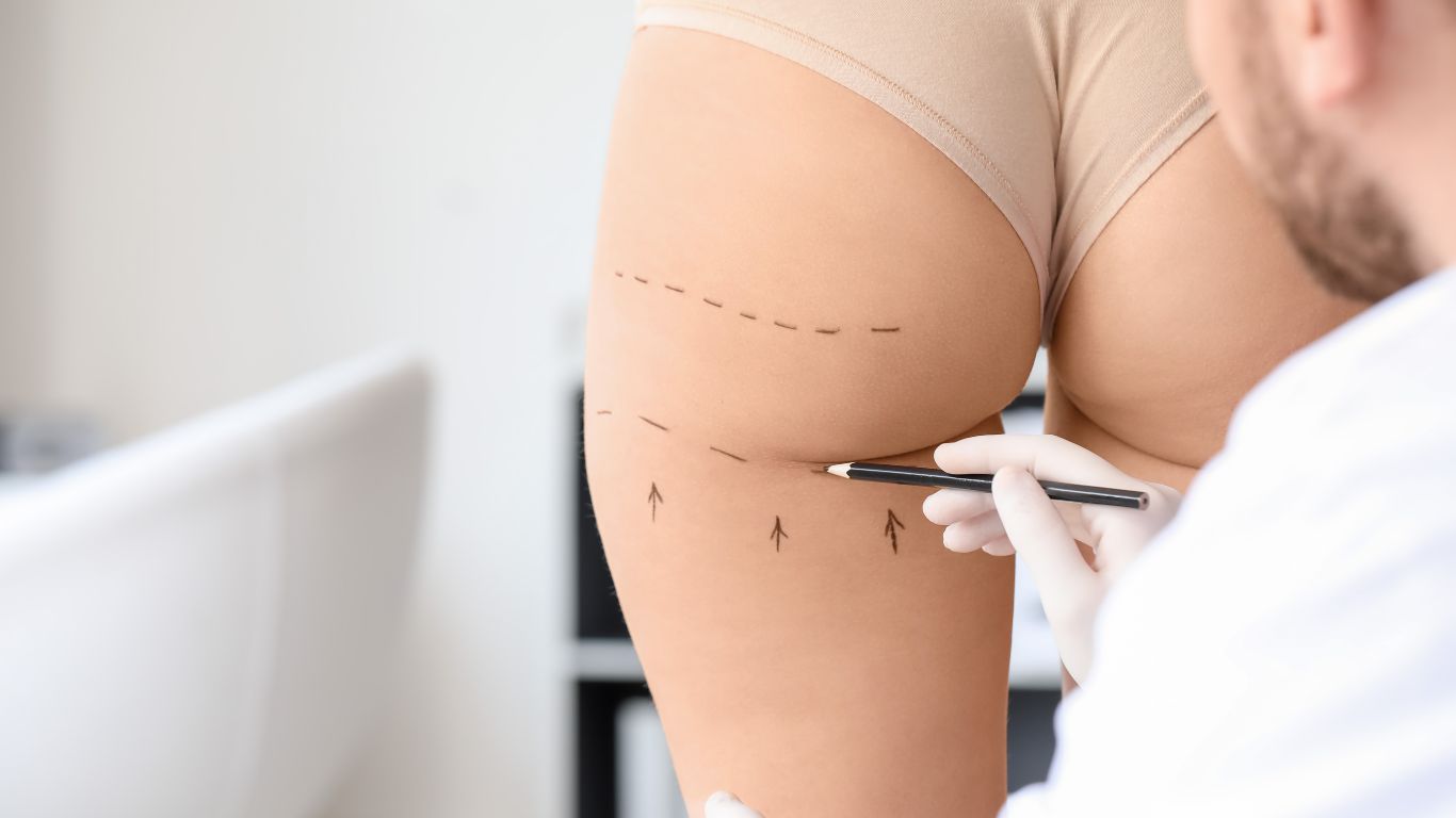 دكتور محمود مندور تجميل المؤخرة