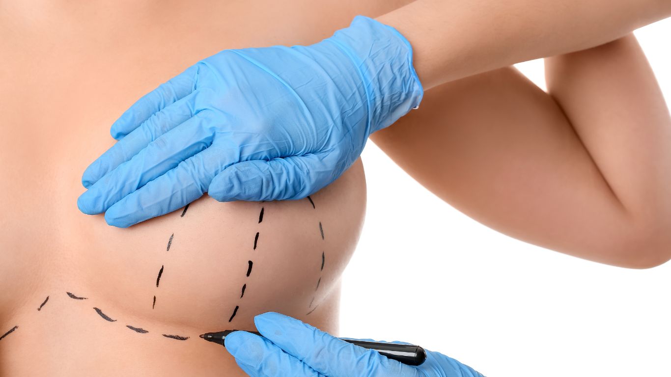 دكتور محمود مندور تجميل الثدي
