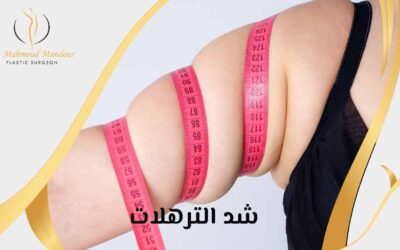 شد الترهلات 