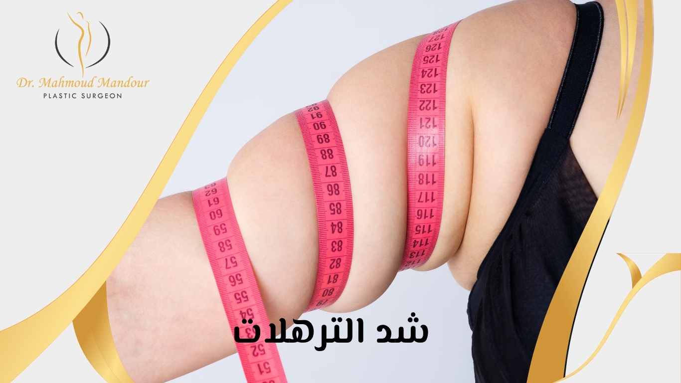 عملية-شد-الترهلات