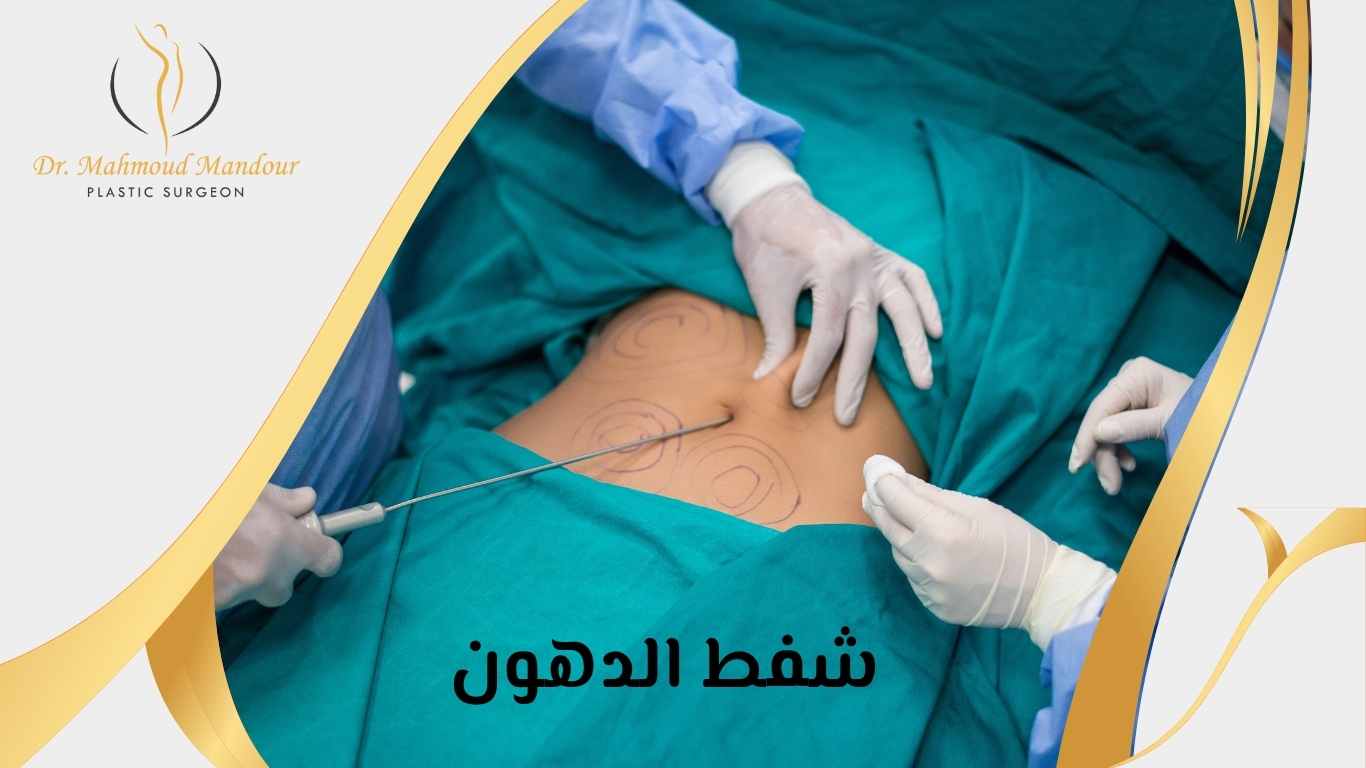 عملية-شفط-الدهون